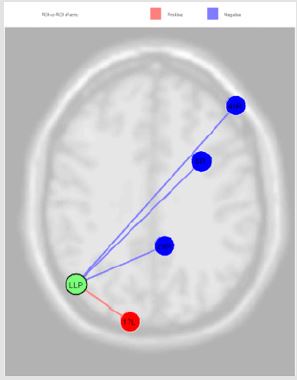 biomedres-openaccess-journal-bjstr