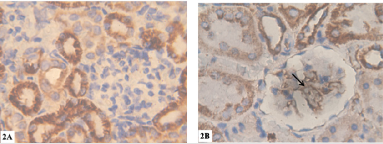 biomedres-openaccess-journal-bjstr