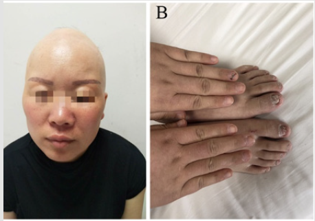 biomedres-openaccess-journal-bjstr