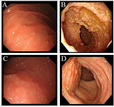 biomedres-openaccess-journal-bjstr