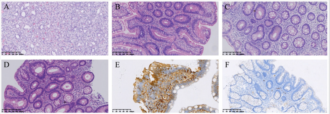 biomedres-openaccess-journal-bjstr