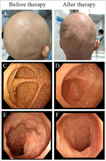 biomedres-openaccess-journal-bjstr