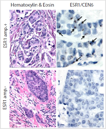biomedres-openaccess-journal-bjstr