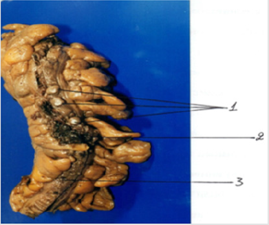 biomedres-openaccess-journal-bjstr