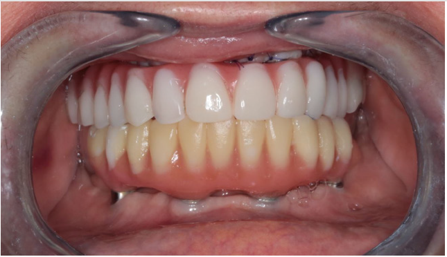 biomedres-openaccess-journal-bjstr