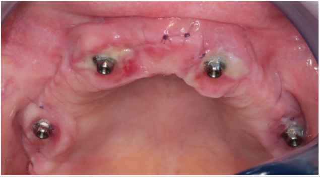 biomedres-openaccess-journal-bjstr