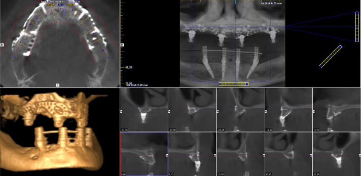 biomedres-openaccess-journal-bjstr