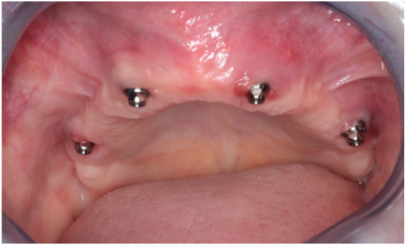 biomedres-openaccess-journal-bjstr