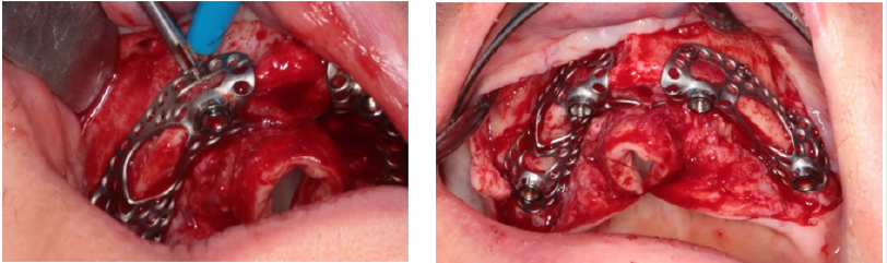 biomedres-openaccess-journal-bjstr
