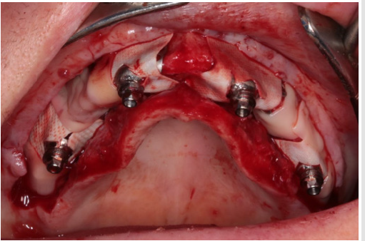 biomedres-openaccess-journal-bjstr