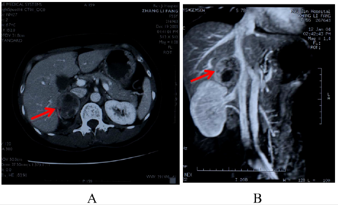 biomedres-openaccess-journal-bjstr