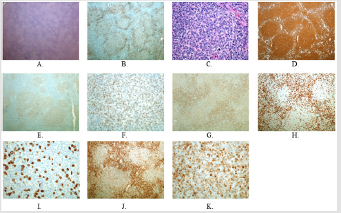 biomedres-openaccess-journal-bjstr