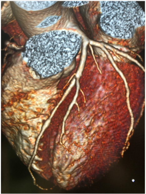 biomedres-openaccess-journal-bjstr
