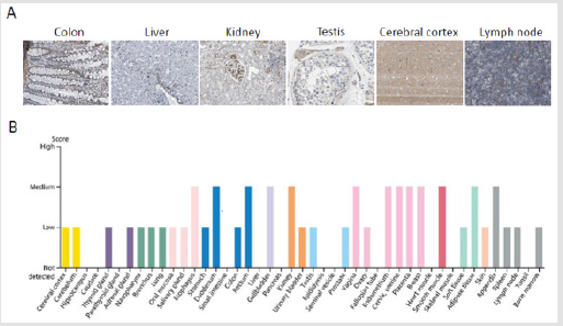 biomedres-openaccess-journal-bjstr