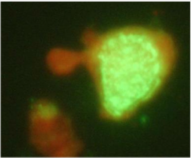 biomedres-openaccess-journal-bjstr