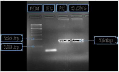 biomedres-openaccess-journal-bjstr