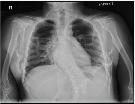 biomedres-openaccess-journal-bjstr