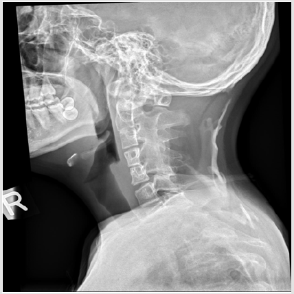biomedres-openaccess-journal-bjstr