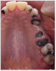 biomedres-openaccess-journal-bjstr