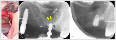 biomedres-openaccess-journal-bjstr