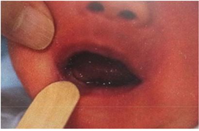 biomedres-openaccess-journal-bjstr