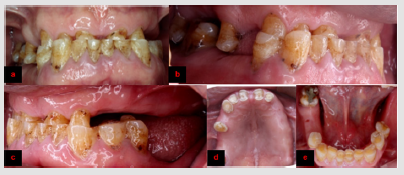 biomedres-openaccess-journal-bjstr