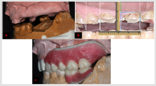 biomedres-openaccess-journal-bjstr