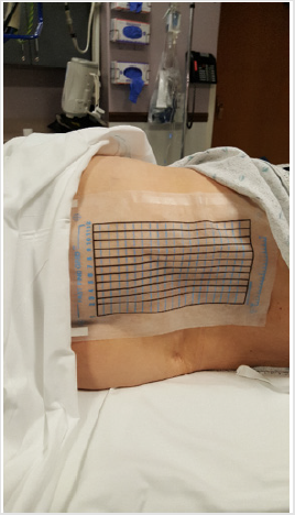biomedres-openaccess-journal-bjstr