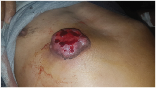 biomedres-openaccess-journal-bjstr