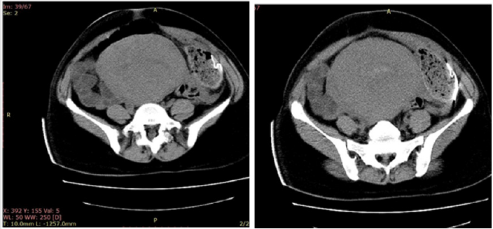 biomedres-openaccess-journal-bjstr