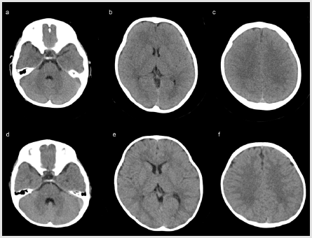 biomedres-openaccess-journal-bjstr