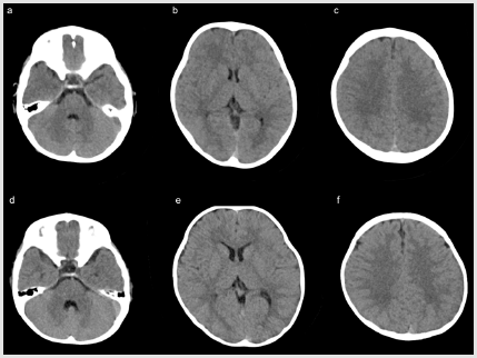 biomedres-openaccess-journal-bjstr