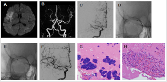 biomedres-openaccess-journal-bjstr
