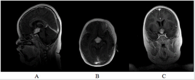biomedres-openaccess-journal-bjstr