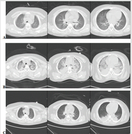 biomedres-openaccess-journal-bjstr