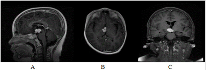 biomedres-openaccess-journal-bjstr