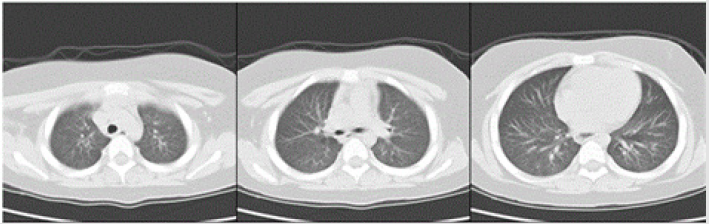 biomedres-openaccess-journal-bjstr