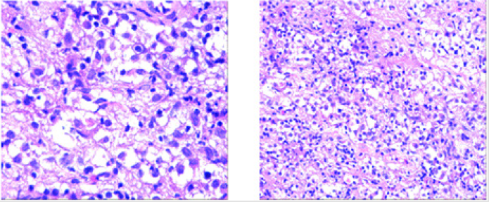 biomedres-openaccess-journal-bjstr