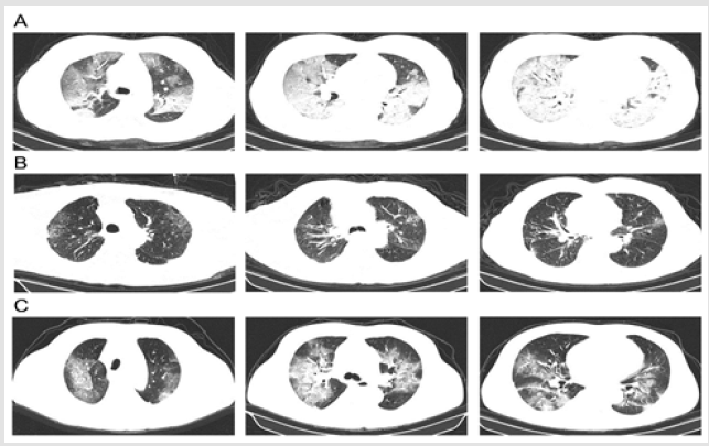 biomedres-openaccess-journal-bjstr