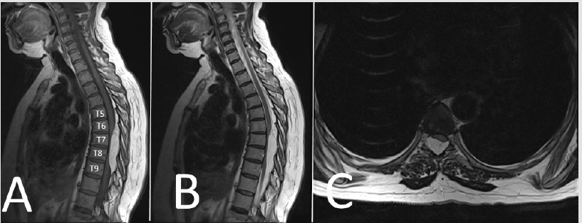 biomedres-openaccess-journal-bjstr
