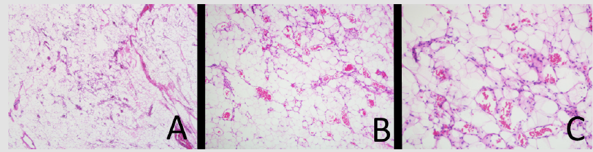 biomedres-openaccess-journal-bjstr