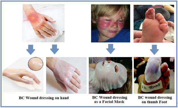 biomedres-openaccess-journal-bjstr