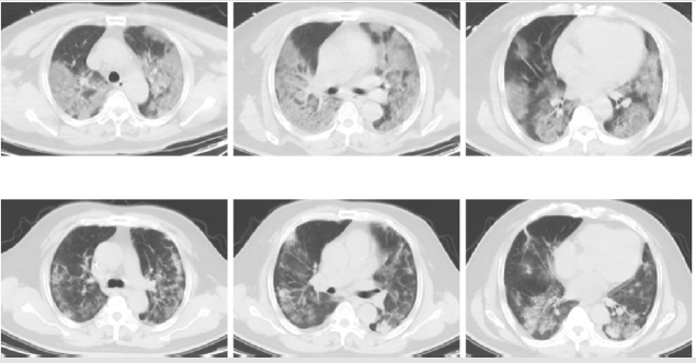 biomedres-openaccess-journal-bjstr
