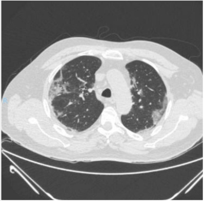 biomedres-openaccess-journal-bjstr
