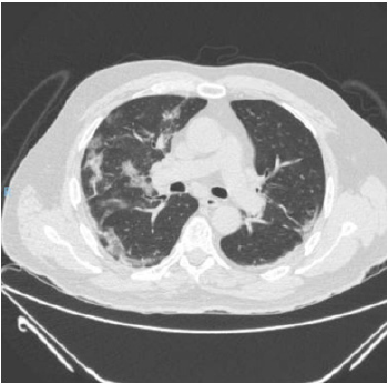 biomedres-openaccess-journal-bjstr