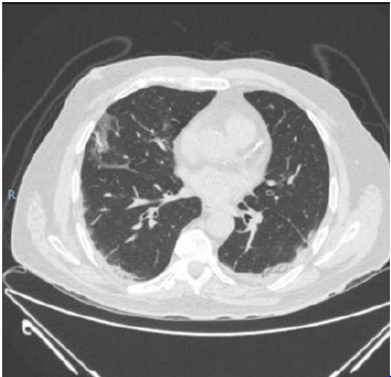 biomedres-openaccess-journal-bjstr