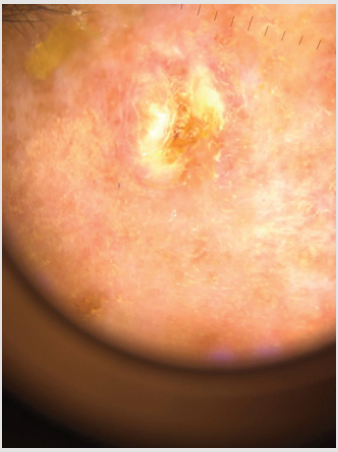 biomedres-openaccess-journal-bjstr
