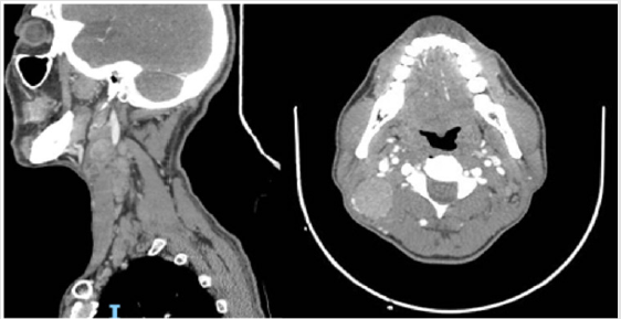 biomedres-openaccess-journal-bjstr