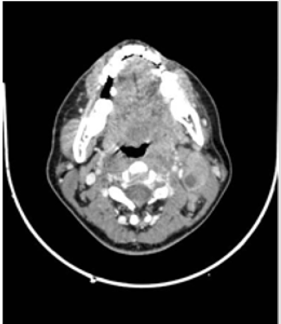 biomedres-openaccess-journal-bjstr