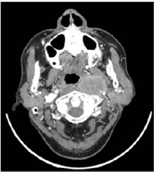 biomedres-openaccess-journal-bjstr